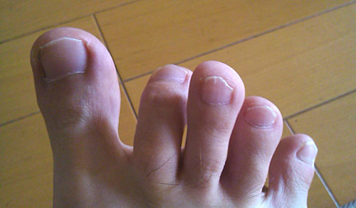 左足の指